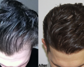 before-image