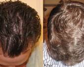 before-image