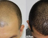 before-image