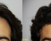before-image