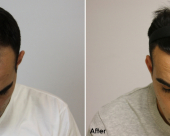 before-image
