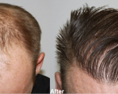 before-image