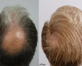 before-image