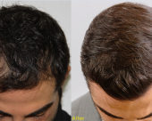 before-image