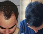 before-image