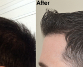 before-image
