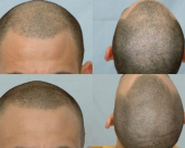 before-image