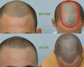 before-image