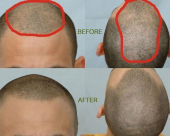before-image