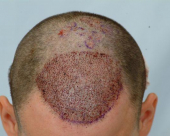 before-image
