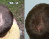 before-image