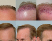 before-image