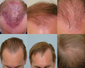 before-image