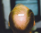 before-image