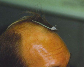 before-image