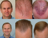 before-image