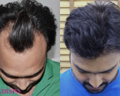 before-image