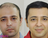before-image