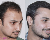 before-image