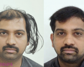 before-image