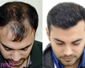 before-image