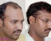 before-image