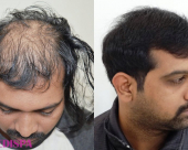 before-image